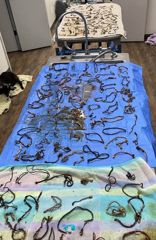 At least 160 hair ties were removed. Picture: Facebook