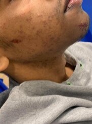 The teen suffered face, shoulder and leg cuts as well as bruising. Picture: Monica Kelly