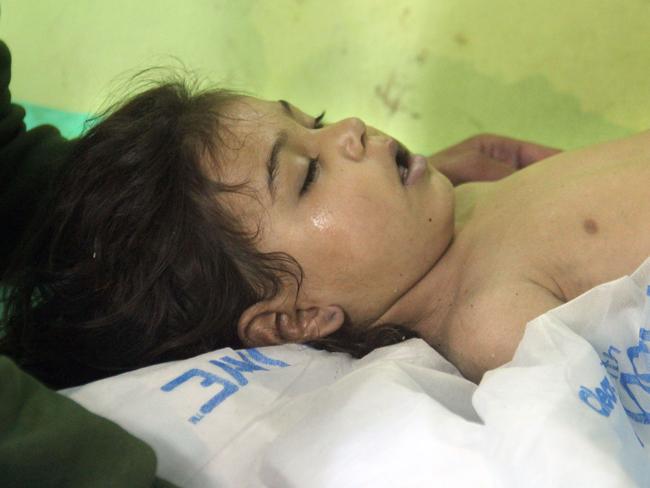 An unconscious child receives treatment following the suspected toxic gas attack which hit the rebel-held town. Picture:/Omar haj Kadour/AFP