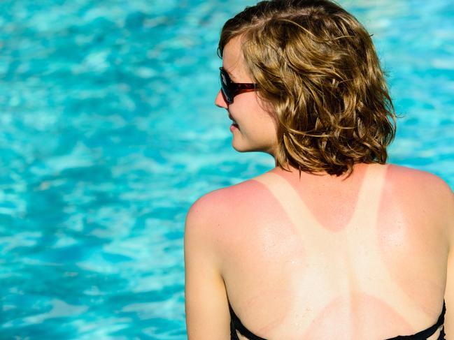 A smiling female sitting next to a pool with a tan line and sunburn on her back.