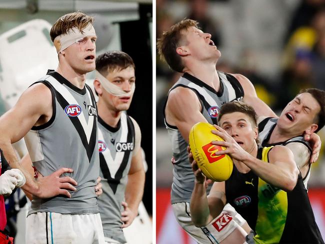 AFL erupts over sickening ‘car crash’