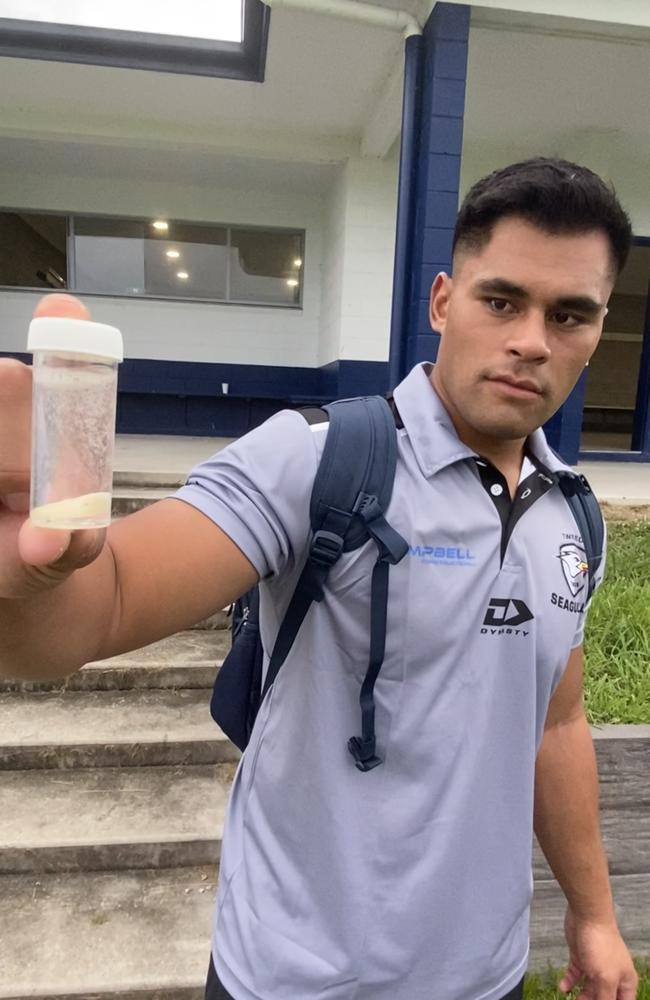 Titans forward Herman Ese'ese poses with tooth knocked out in Tweed v Capras ISC match. Picture: Nic Darveniza