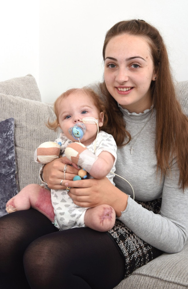 His mum Abigail has shared his story to help other parents spot the signs. Picture: Caters News
