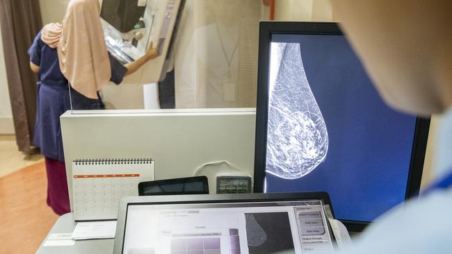 Radiology body president urges action on breast imaging shortage. File photo.