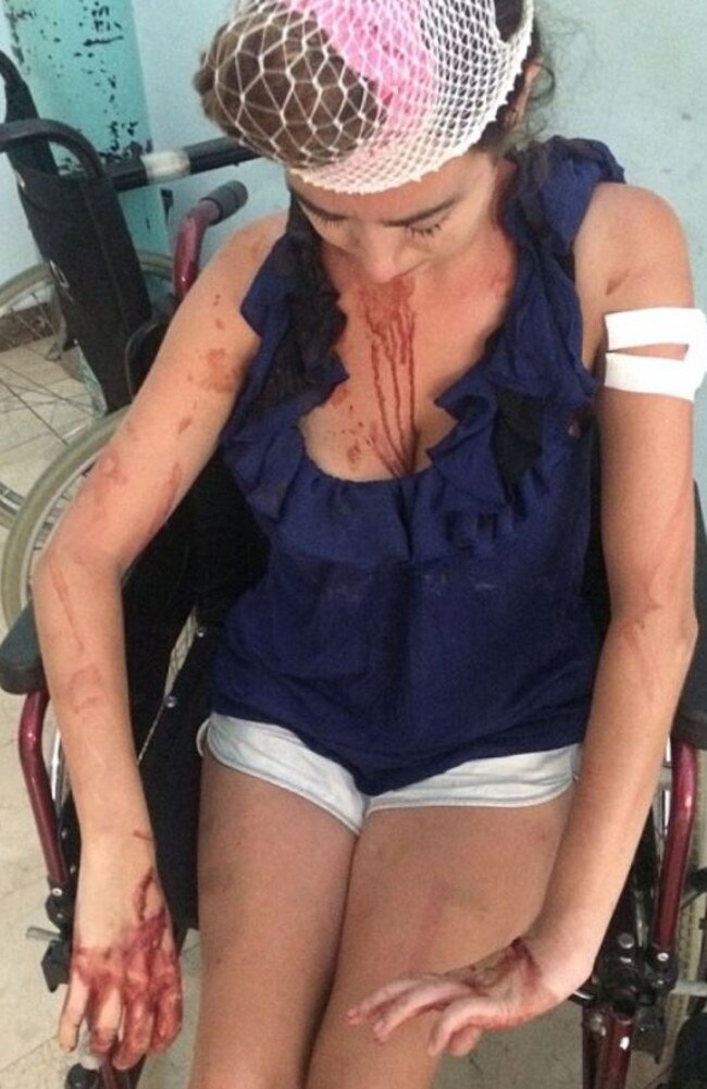 British tourist Laura Denmar said staff at a hostel in Split, Croatia beat her with a metal pole.