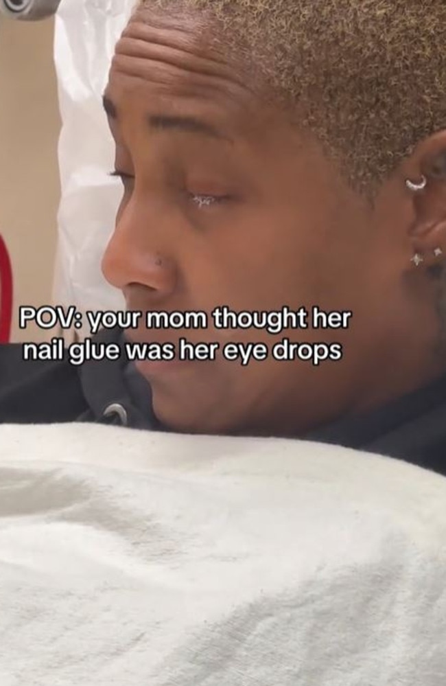 The mistake means her eye could be sealed shut for seven weeks. Picture: TikTok/@realbyriri