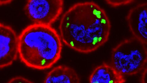 An image of cytokine-secreting cells, with the green markers indicating more productive cells. Picture: Centre of Excellence for Nanoscale BioPhotonics.