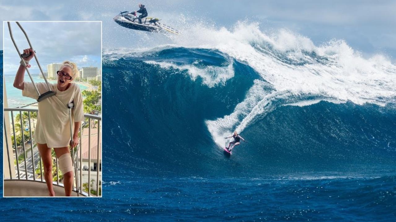 ‘Scary situation’: Big wave champ back in the water after horror injury