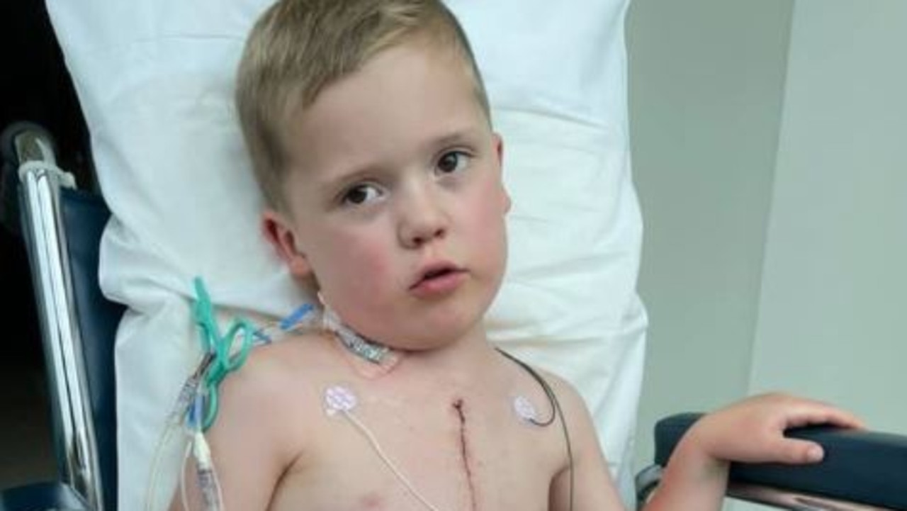 William Bayliss, 4, of Victoria, was born with half a heart and his only wish this Christmas is for Santa to bring him a new heart. Picture: GoFundMe