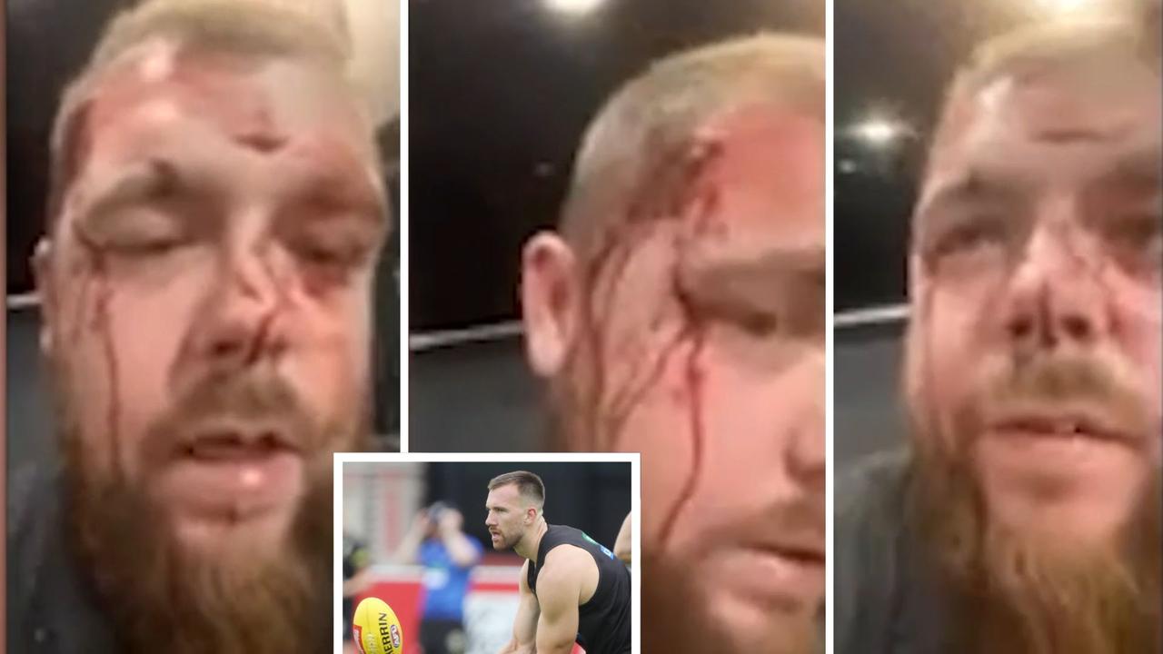 Footy star’s assault victim in shocking video