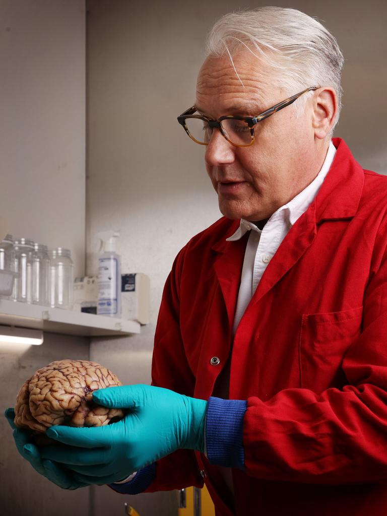 Dr Michael Buckland with a human brain at the Australian Sports Brain Bank. Photo: John Feder/The Australian.