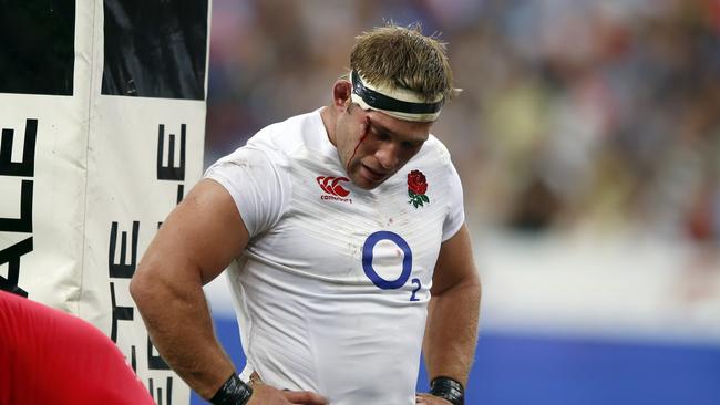 England’s Tom Youngs with blood on his face looks on during the France vs. England rugby friendly match at Stade de France.