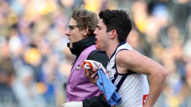 Brayshaw leaves the ground with a bloodied mouth in the Round 20 derby against West Coast. Picture: AAP