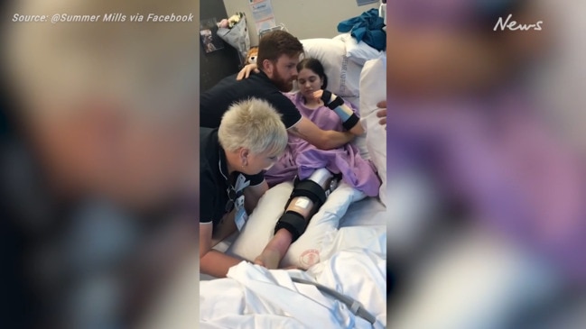 Summer Mills' shares harrowing recovery after car crash