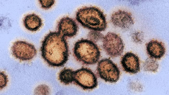 An image of the coronavirus, taken by a transmission electron microscope. Picture: National Institutes of Health