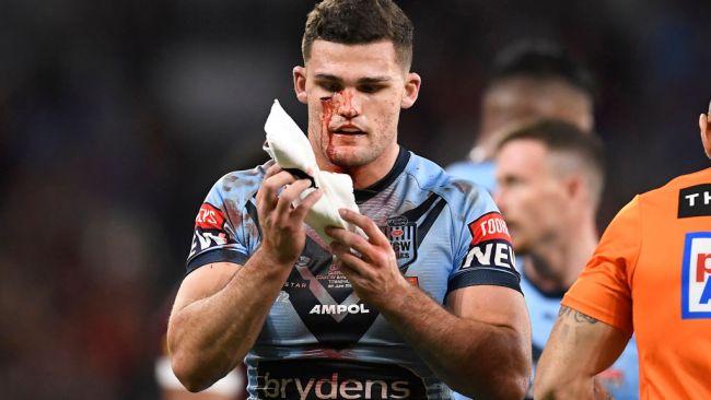 TOWNSVILLE, AUSTRALIA - JUNE 09:  Nathan Cleary of the Blues is attended to by a team trainer after a cut to his face during game one of the 2021 State of Origin series between the New South Wales Blues and the Queensland Maroons at Queensland Country Bank Stadium on June 09, 2021 in Townsville, Australia. (Photo by Ian Hitchcock/Getty Images)