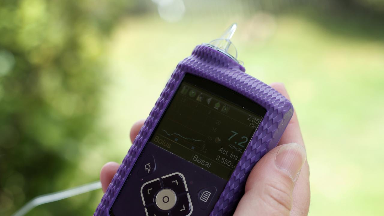 The insulin pump that some type 1 diabetes patients use. Generic Picture: Luke Bowden