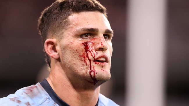 Nathan Cleary was in the wars early in the first half.