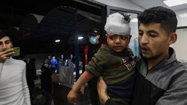 A child is injured by an Israeli strike. Picture: Ahmad Hasaballah