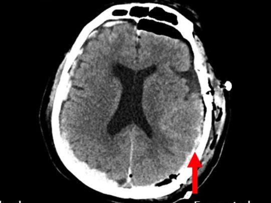 First-ever recording of a dying human brain reveals what happens when we die. Picture: Frontiers in Aging Neuroscience