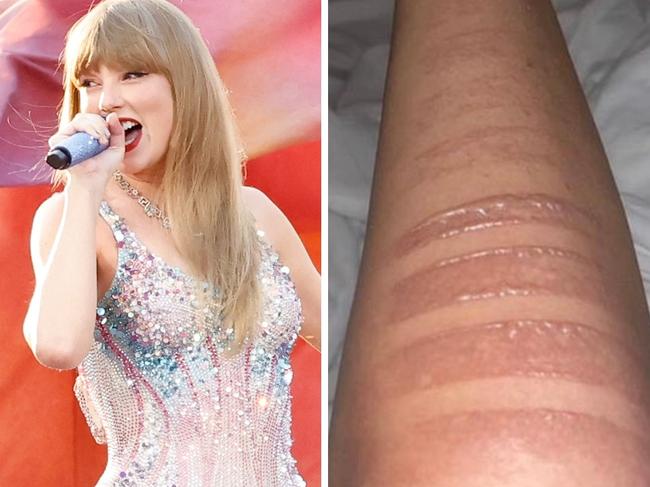 Swift fans have alleged they face scalding burns from metal flooring.