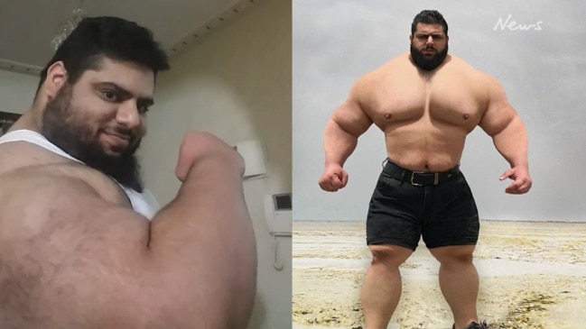 What Is Synthol And Why Are Guys Using It?