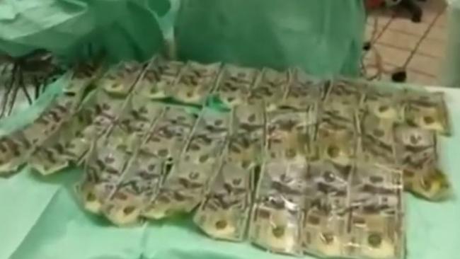 The woman in Colombia swallowed $7000 cash to spite her cheating husband. Picture: Reuters