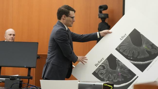 Gwyneth Paltrow's attorney James Egan displays a poster showing a brain scan during her civil trial over a collision with retired optometrist Terry Sanderson. Picture: Getty