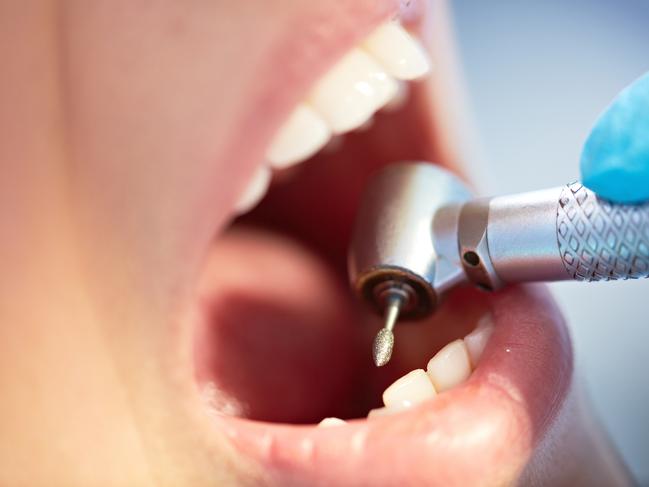 Fluoride reduces tooth decay. Photo: iStock