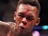 Adesanya an Aussie headliner, with or without Bobby Knuckles