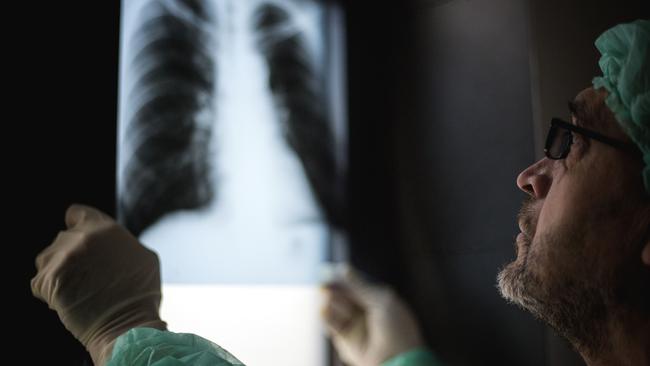 Stonemasons must be provided with regular health checks, including lung X-rays, from their employers under a new code of practice enforced by the Queensland Government.