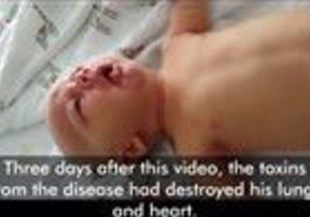 AU WA:    Video Shows Baby Riley's Last Moments Before he Died From Whooping Cough As Authorities Issue Outbreak Warning   March 15