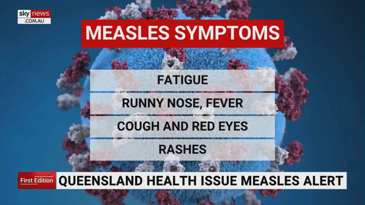 Queensland on notice over potential measles outbreak