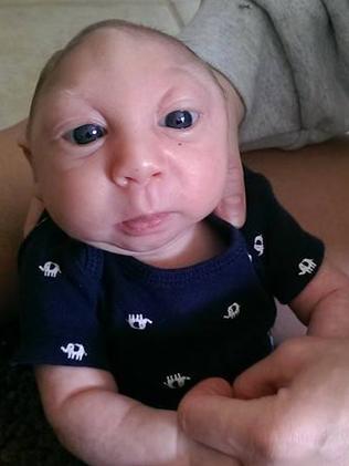 Jaxon Emmett Buell: Baby born with most of his skull missing celebrates ...