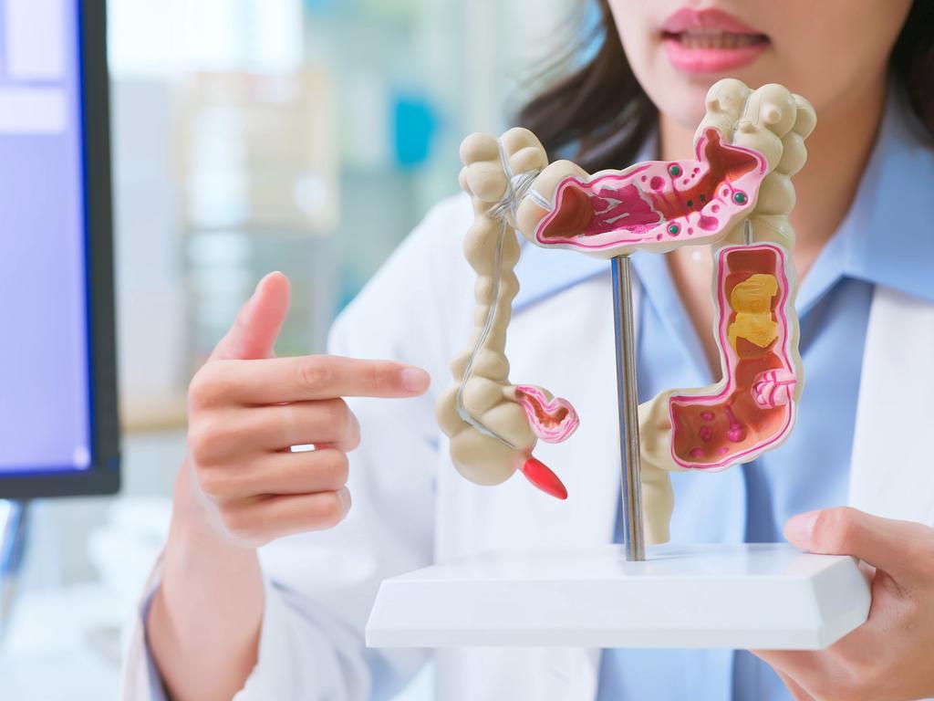 About 20 per cent of all US colorectal cancer diagnoses are in individuals younger than 50. Picture: iStock