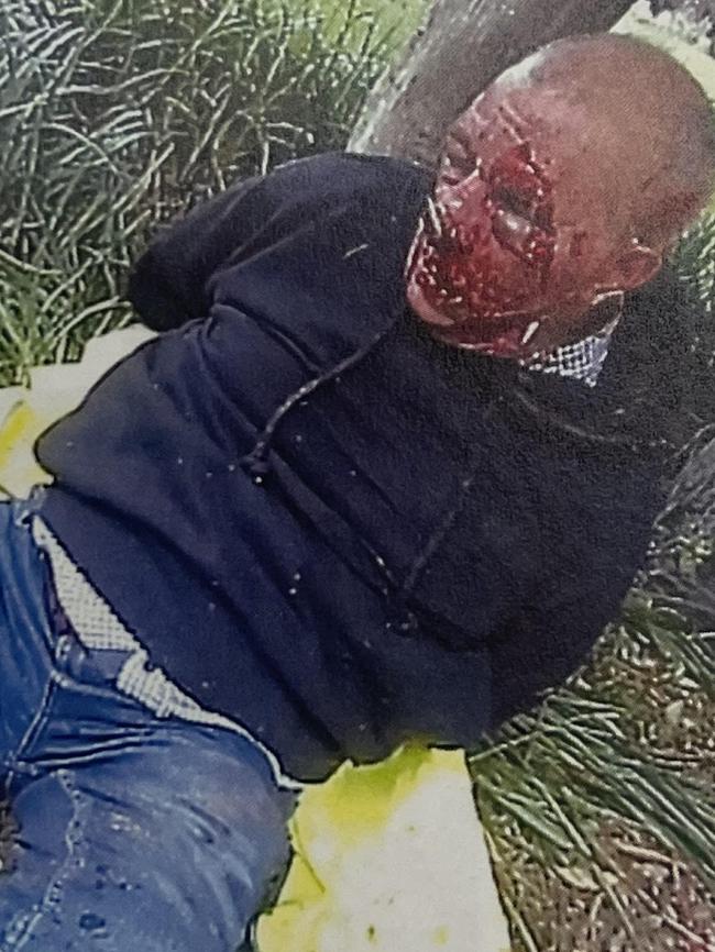 Murrell was left bloodied and with broken bones after Mr Uskovic was forced to kick and punch him until police arrived. Picture: Supplied