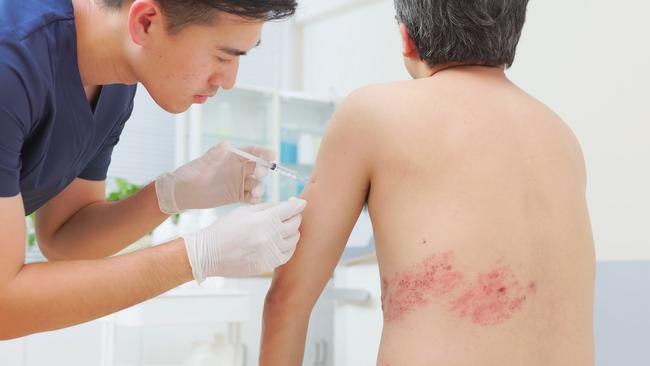 close up asian male doctor is giving man patient an injection shot about his shingles disease on skin   i stock image