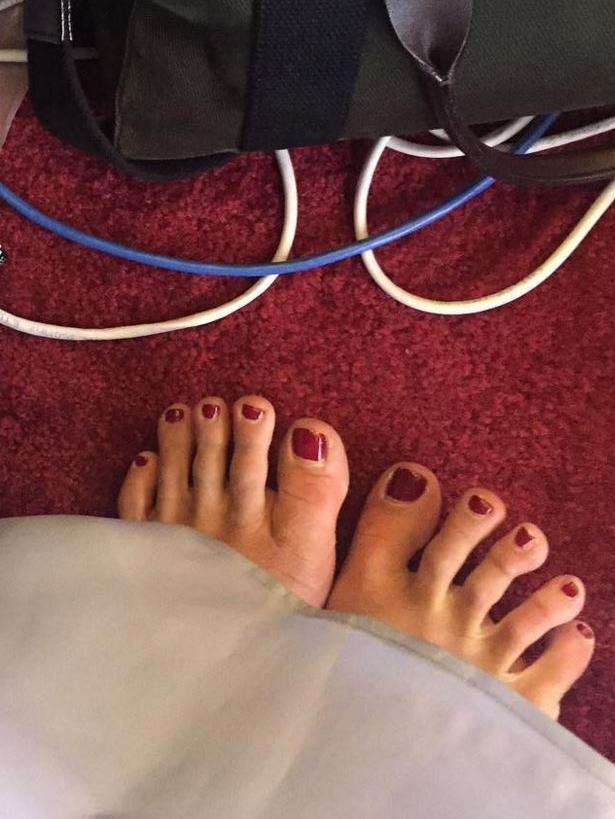 Edwina’s poor tootsies. Picture: Instagram