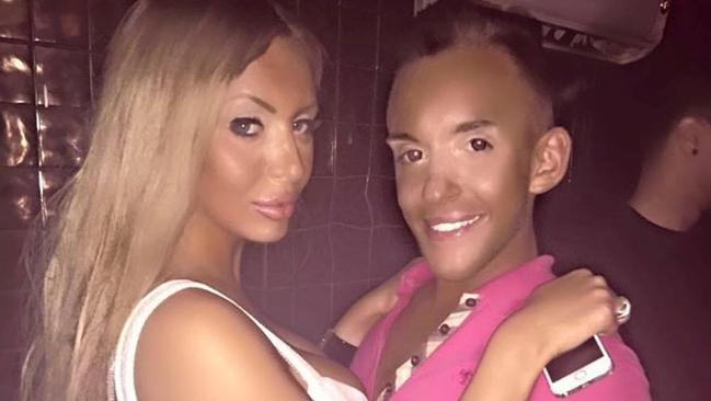 Barbie and Ken in real life Young French couple spend 440k on surgery to look like dolls news Australia s leading news site