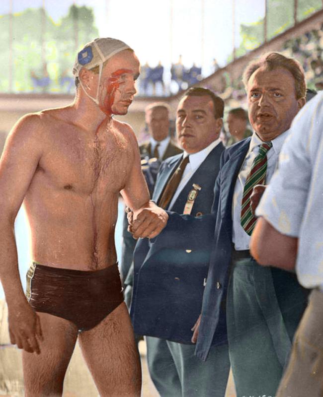 A bloodied Ervin Zador of Hungary emerges form the pool in the water polo match against the Russian team at the 1956 Melbourne Olympic Games.