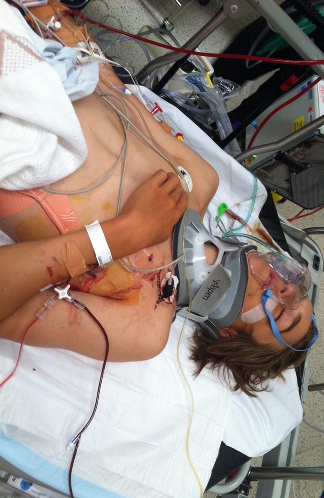 Teen cyclist Ryan Meuleman was rushed to hospital after the crash. Picture: Supplied