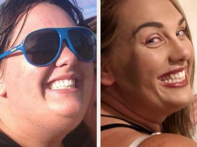 Auckland Woman S Incredible 80kg Weight Loss Herald Sun