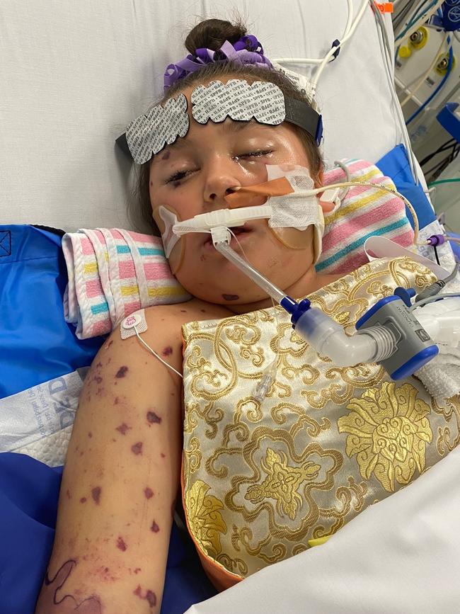 Eight-year-old Aliannah Green-Collins’ life was turned upside down on December 3, 2021, when she was rushed to the Queensland Children’s hospital with suspected meningococcal disease.