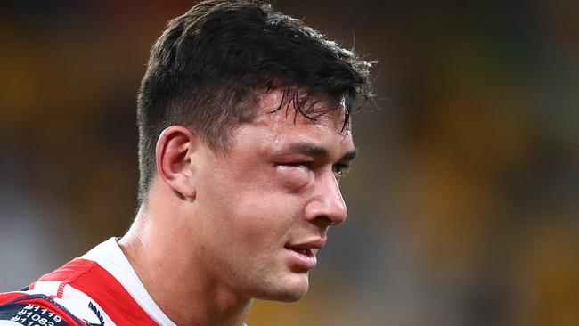 Joseph Manu is undergoing emergency surgery at a Brisbane hospital on Saturday to repair the depressed fractured cheekbone.