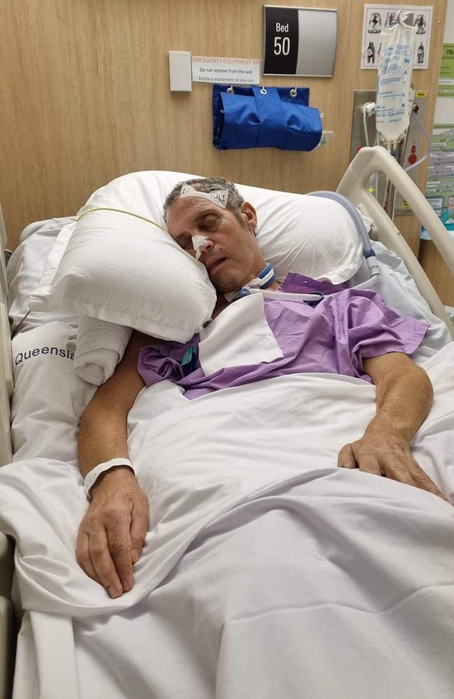 Babis, who lost 38kg while in hospital, suffered a stroke causing him to fall and smash his head on concrete. As a result he suffered a subarachnoid haemorrhage in the brain.