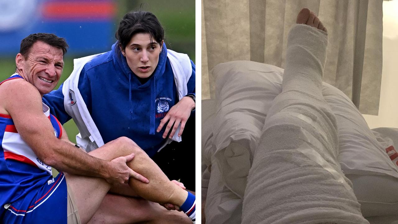 Brent Harvey suffered a horror leg injury.
