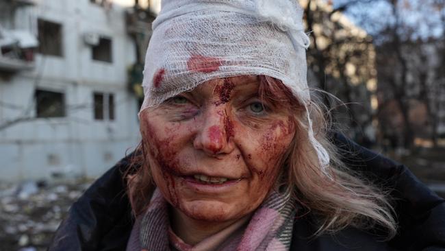 A wounded woman after an air strike damages an apartment complex outside of Kharkiv, Ukraine in February 2022. Picture: Anadolu via Getty Images