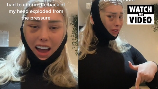 OnlyFans model Weronika says head ‘exploded’ on post surgery flight ...