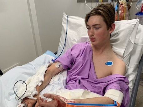 ‘Long way to go’: Teen sustains severe injuries in horror incident