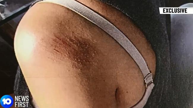 The chilling audio, video footage from body worn police cameras and photos of Ms Ivkovic’s alleged injuries. Picture: Ten News